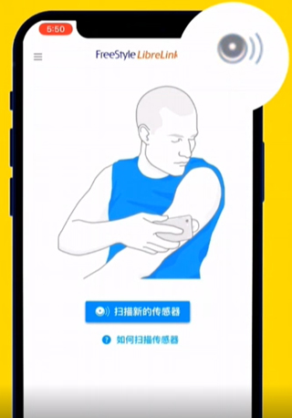 雅培瞬感