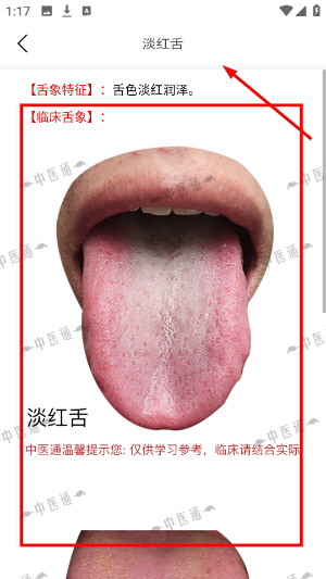 中医通